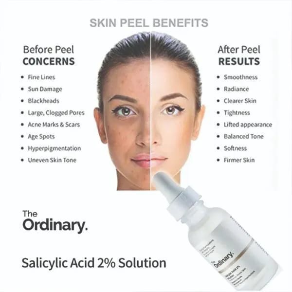 The Ordinary Anti- Acne Niacinamide Serum