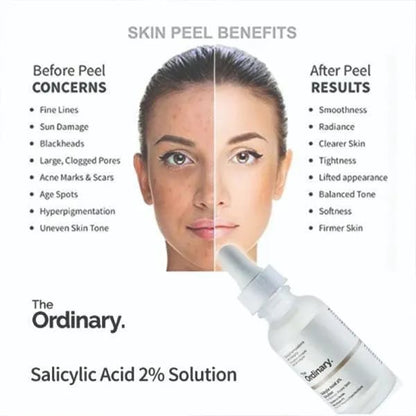 The Ordinary Anti- Acne Niacinamide Serum